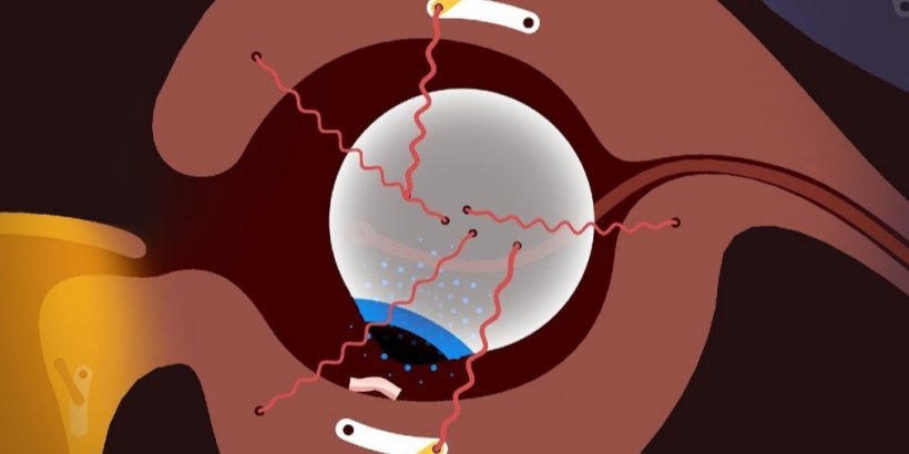 Bacon in Zane lets you explore the human body as a sentient strip of bacon